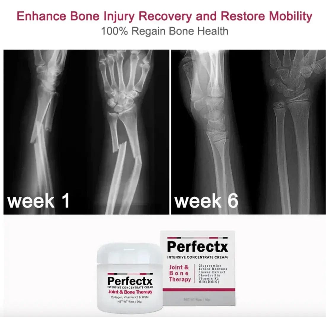 Perfectx™ Terapia Articular Y Muscular CurePro