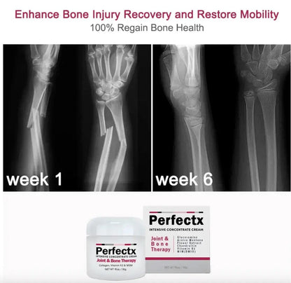 Perfectx™ Terapia Articular Y Muscular CurePro